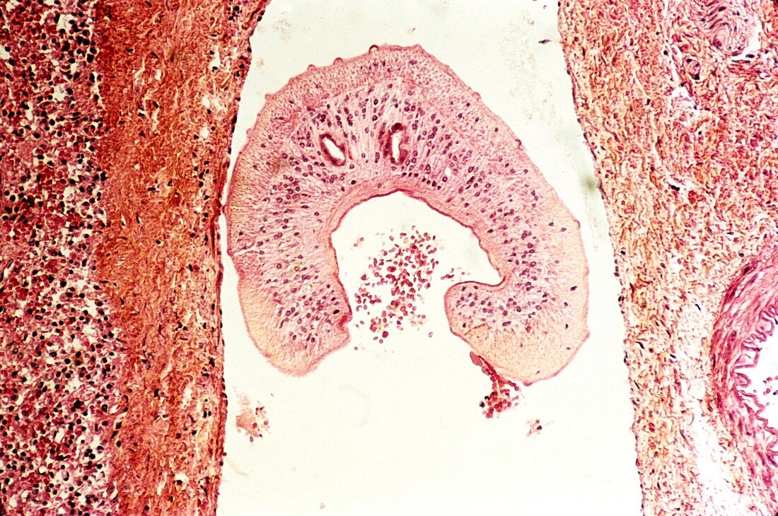 Schistosome parasite,light micrograph