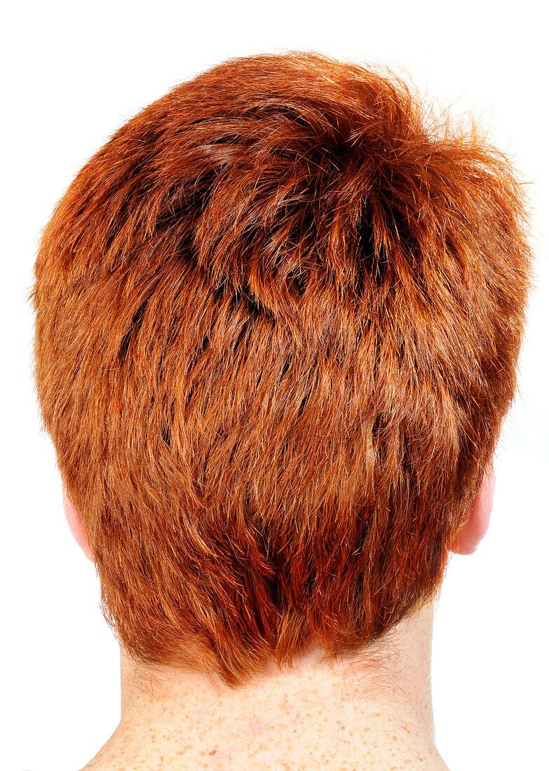 Red-haired teenage boy