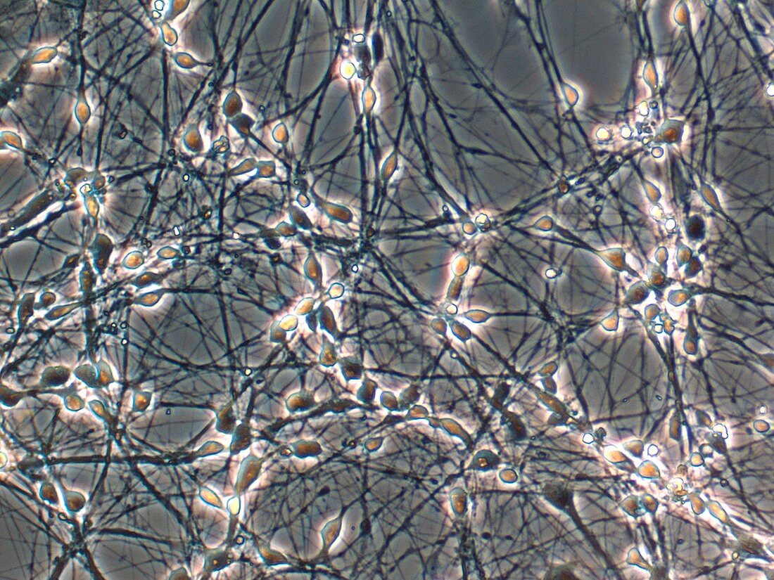 Neurons from stem cells,light micrograph