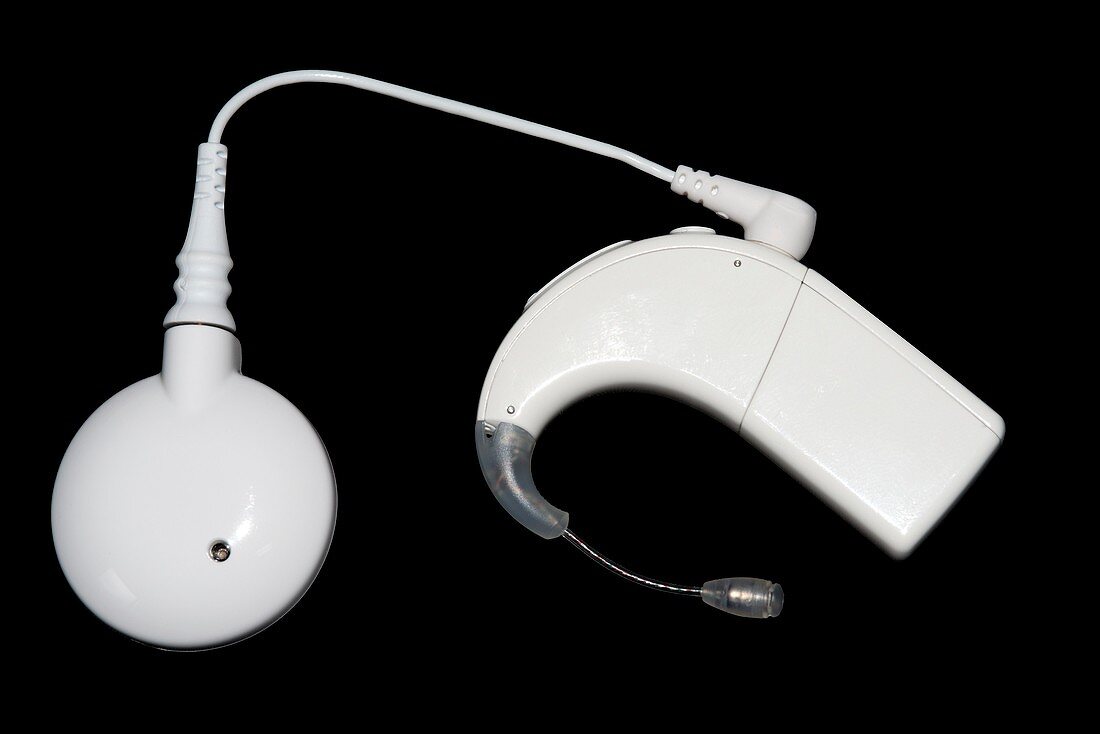 Cochlear implant hearing aid