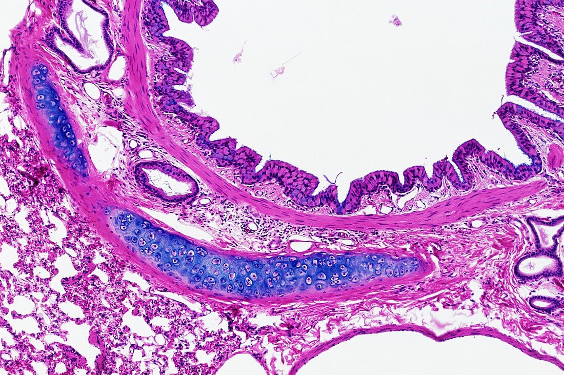 Lung bronchus,light micrograph