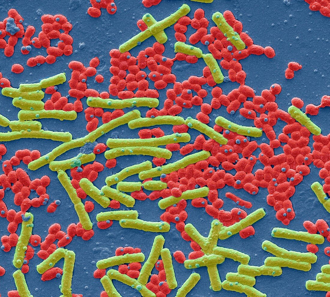 Haemolytic Streptococcus and E coli,SEM