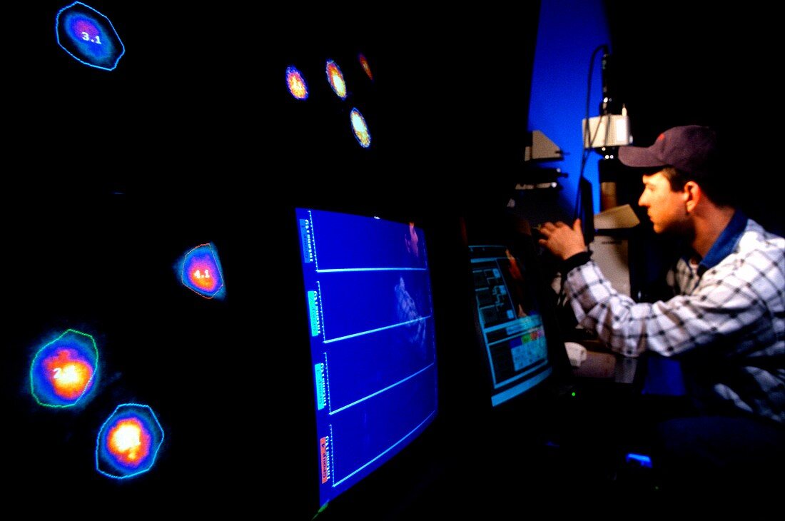 Brain activity fluorescence imaging