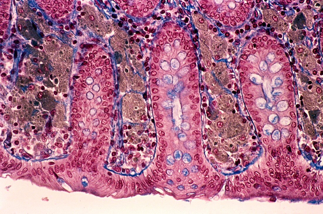 Melanosis coli,light micrograph