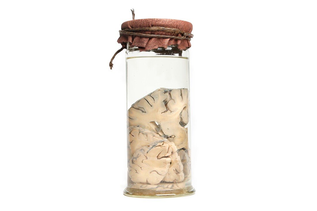 Preserved brain in jar,19th century