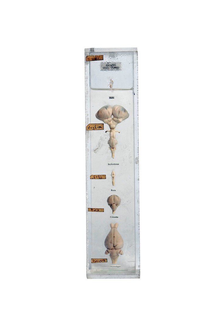 Preserved brains,19th century specimens