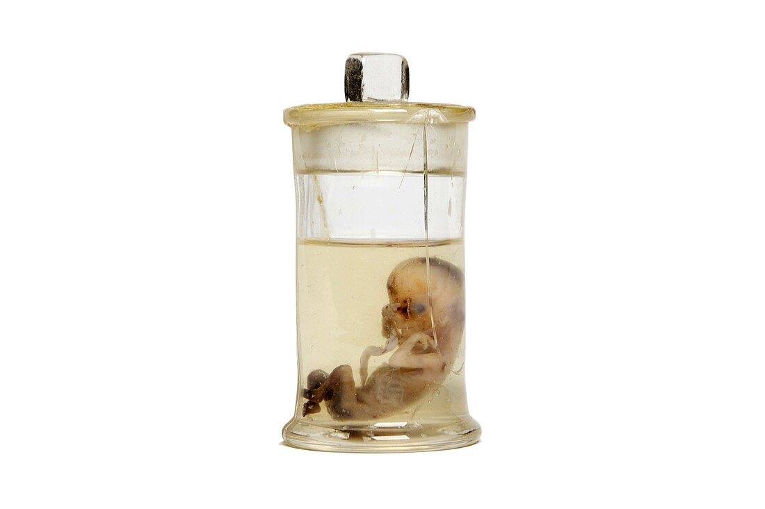 Human foetus,preserved