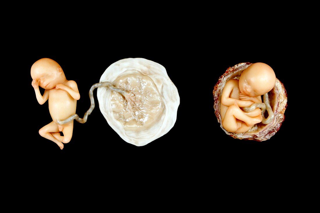 Wax models of human foetus,1850