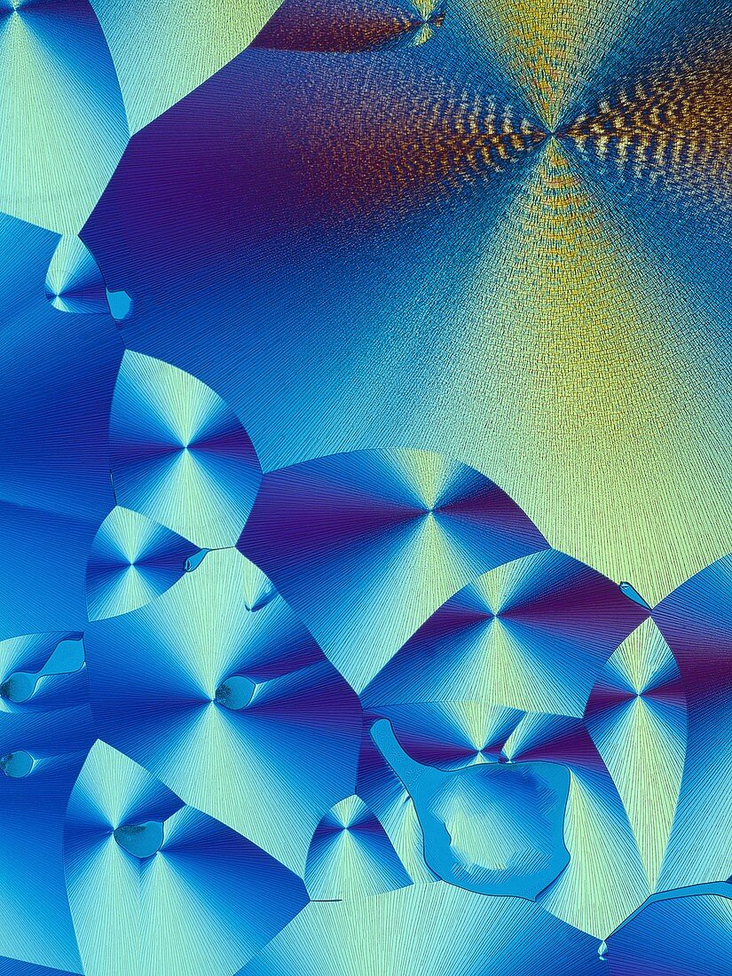 Cortisol crystals,light micrograph