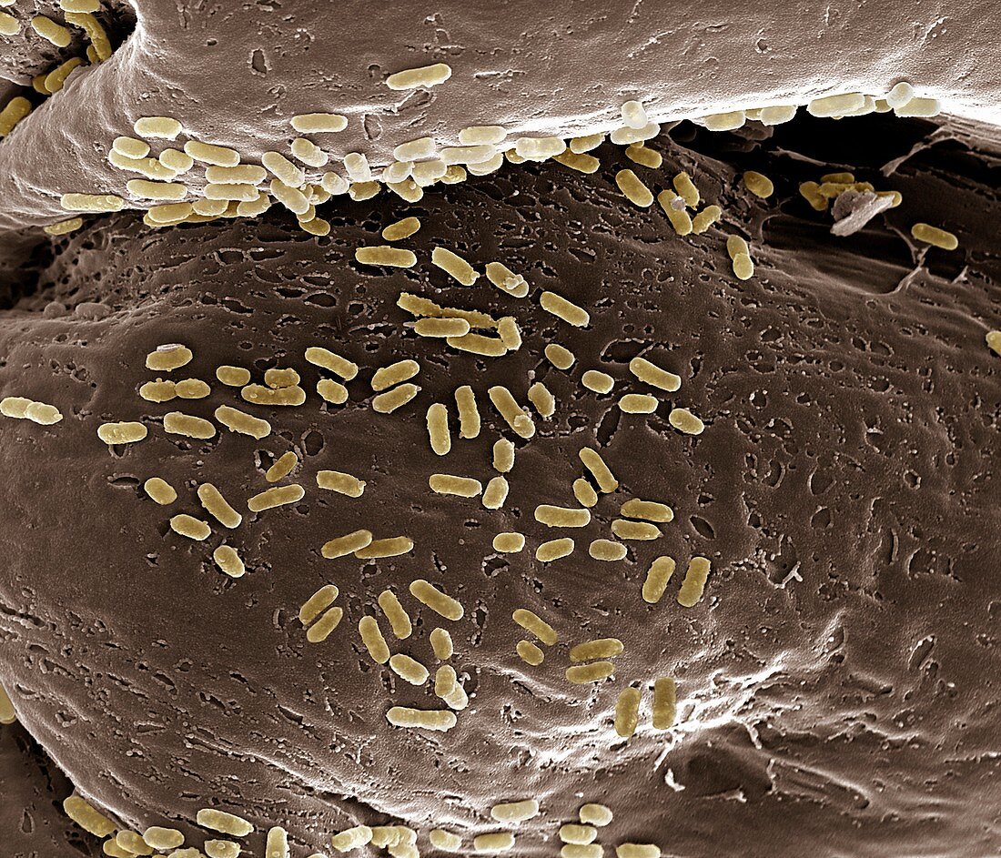 E. coli on a membrane,SEM