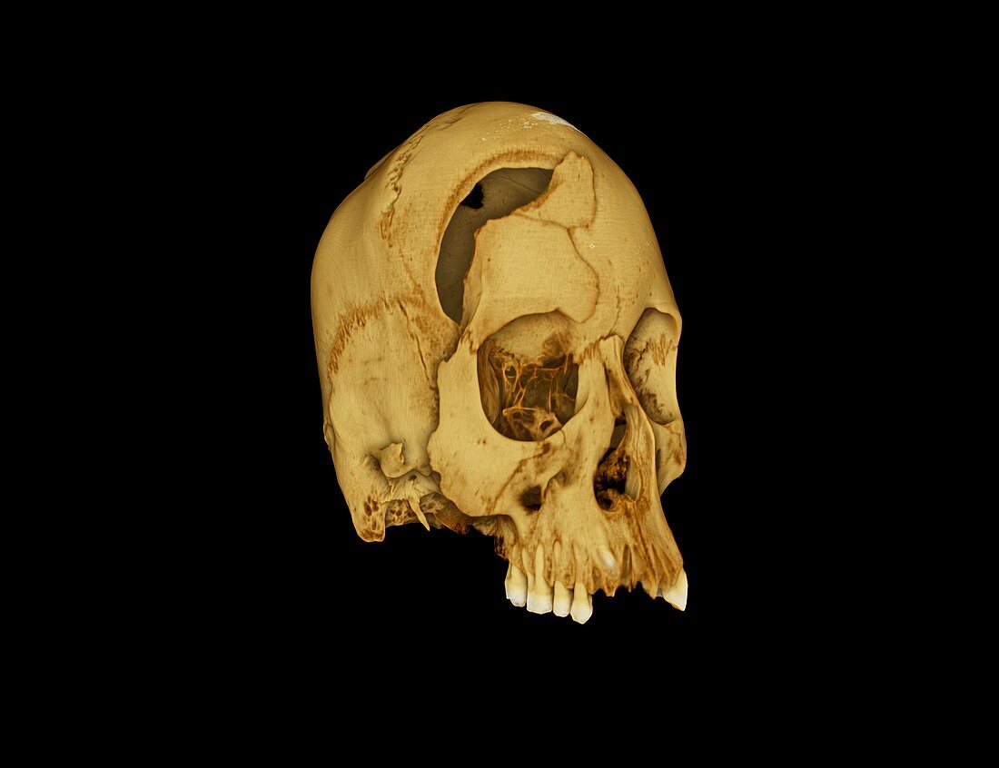 Nubian skull,micro-CT scan
