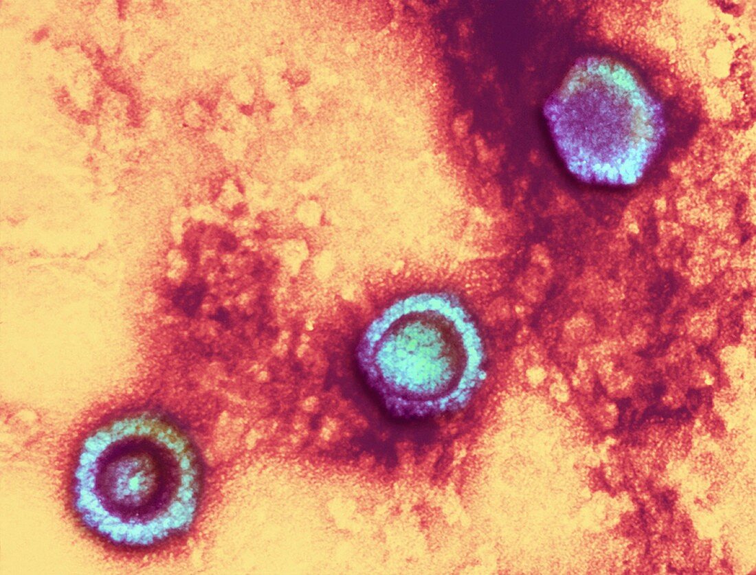 Herpes virus particles,TEM