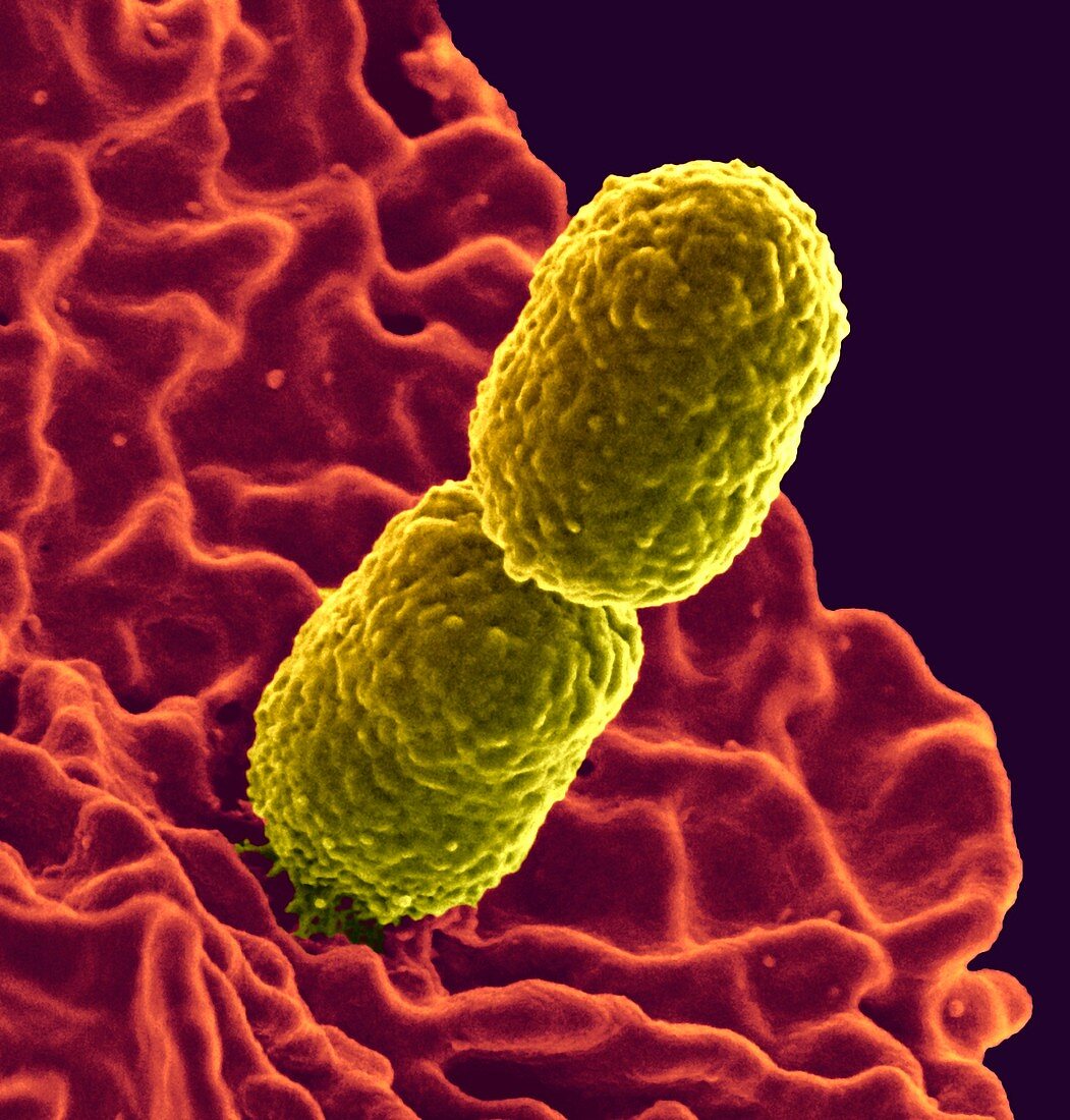 Klebsiella pneumoniae bacteria,SEM