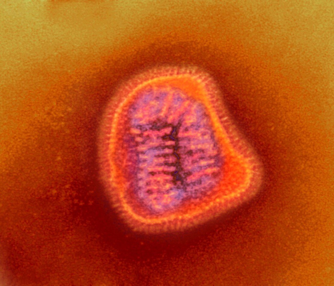 Influenza virus particle,TEM