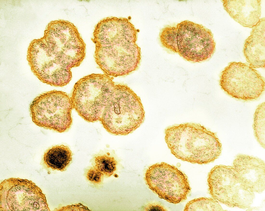 Neisseria gonorrhoeae bacteria,TEM