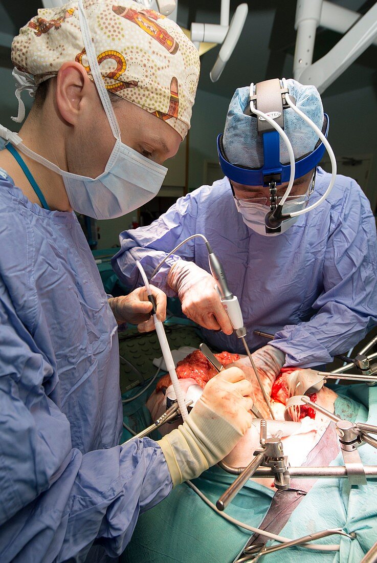 Oesophagogastrectomy surgery