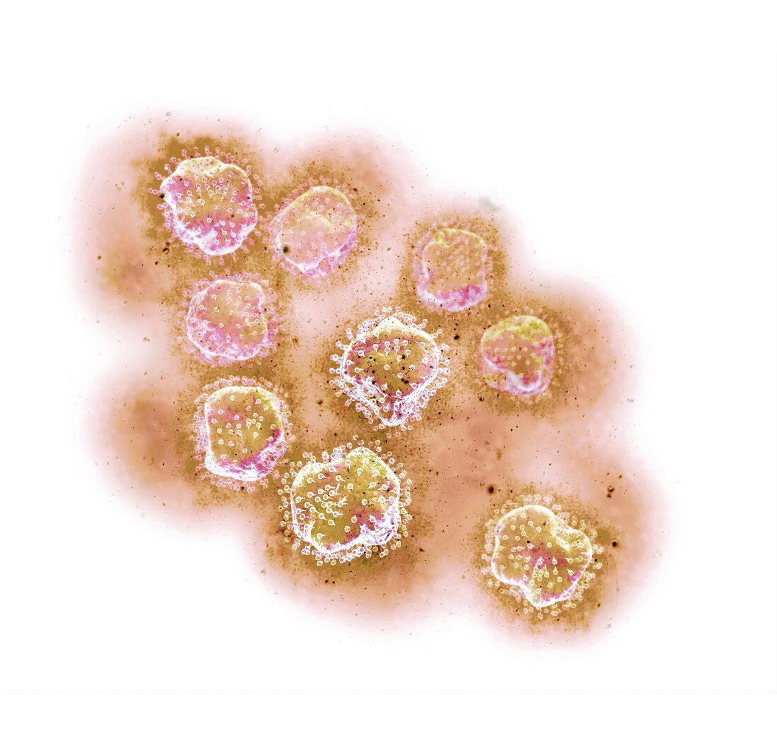 Hepatitis C virus,artwork