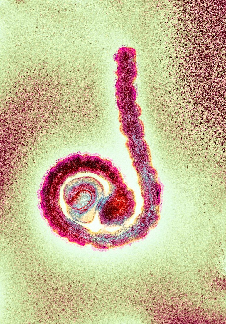 Ebola virus particle,TEM
