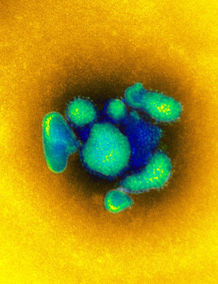 Arenavirus virus particles,TEM