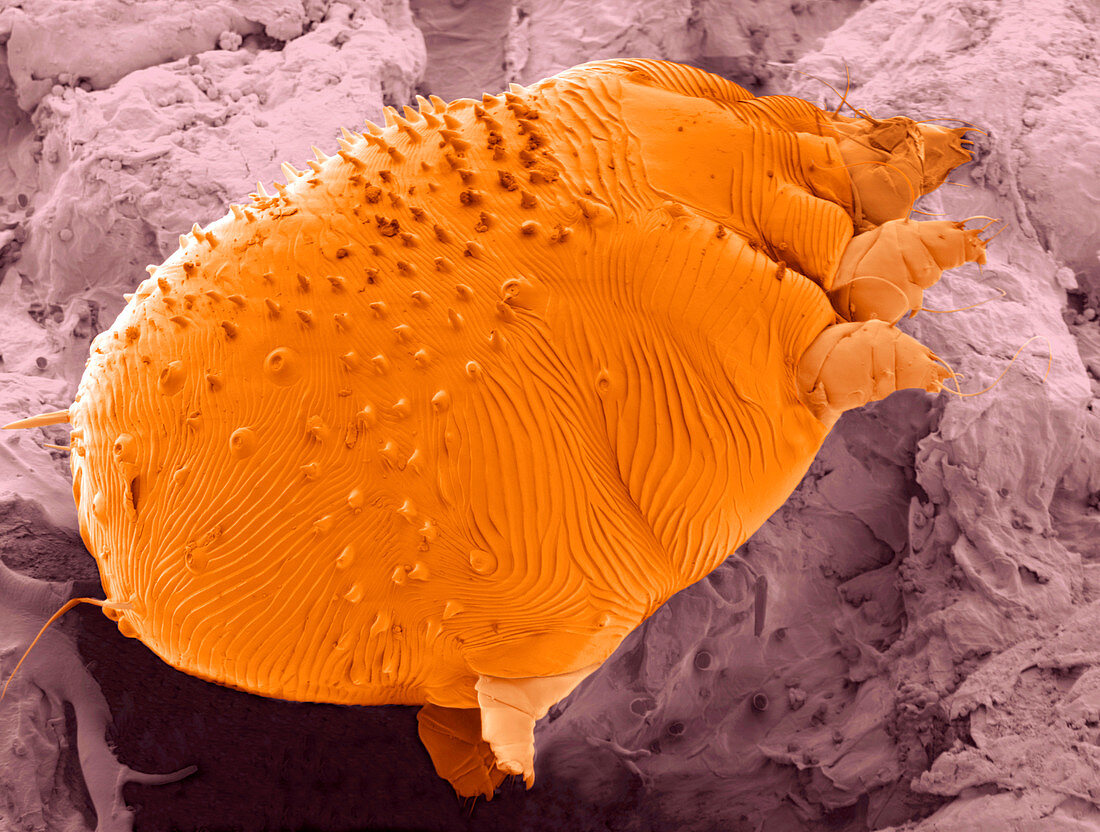 Sarcoptes parasitic mite,ESEM