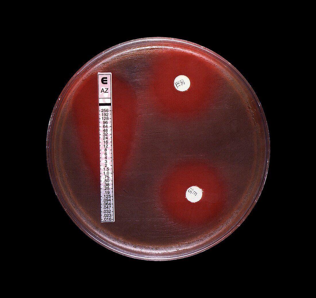 Antimicrobial susceptibility test