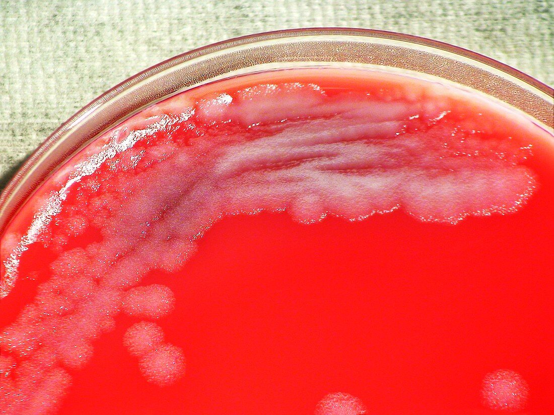 Anthrax bacteria culture
