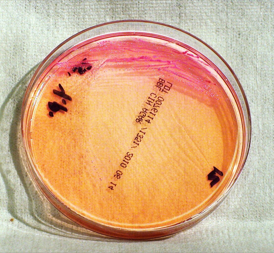 Human plague bacteria culture