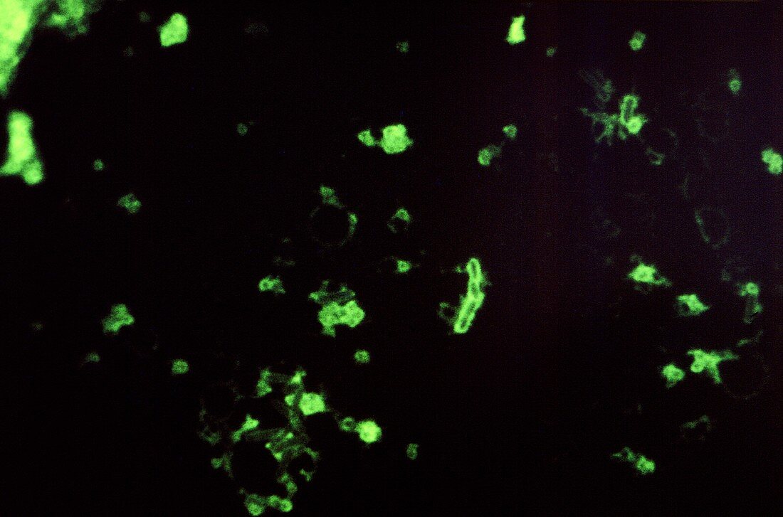 Human plague bacteria,light micrograph