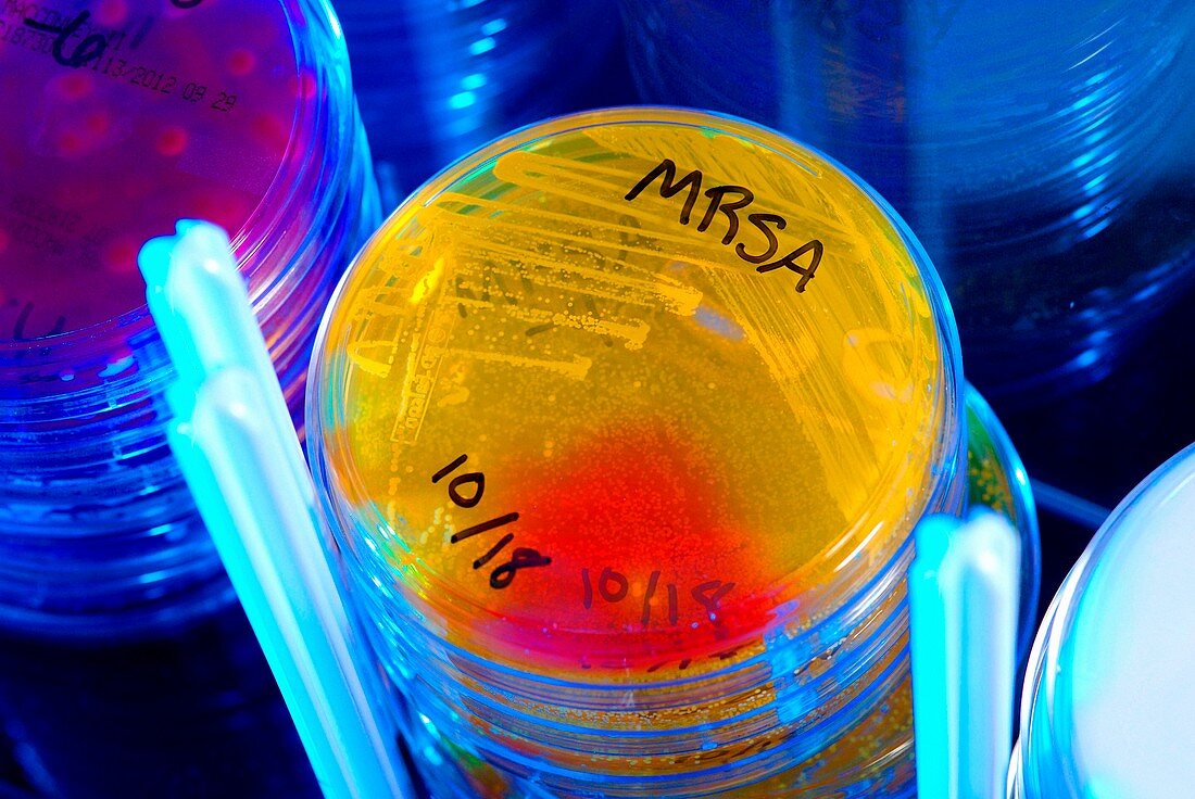 MRSA bacteria culture