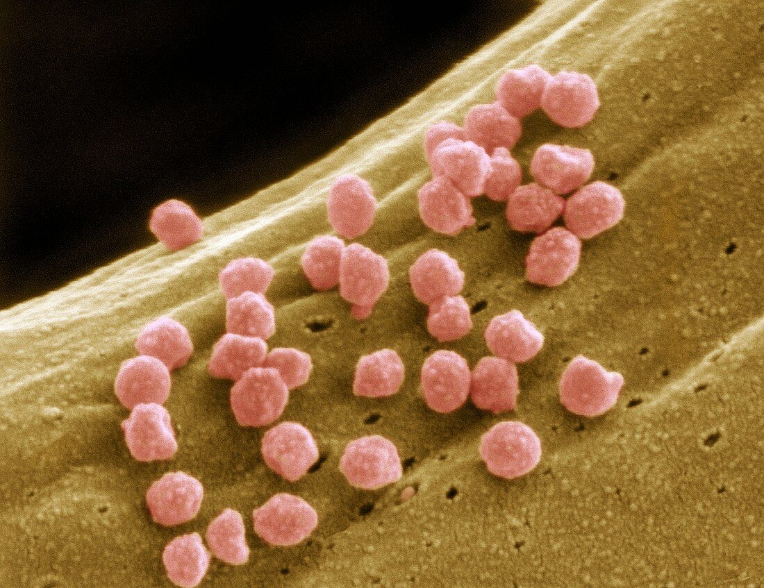 Cell infected with HIV,SEM