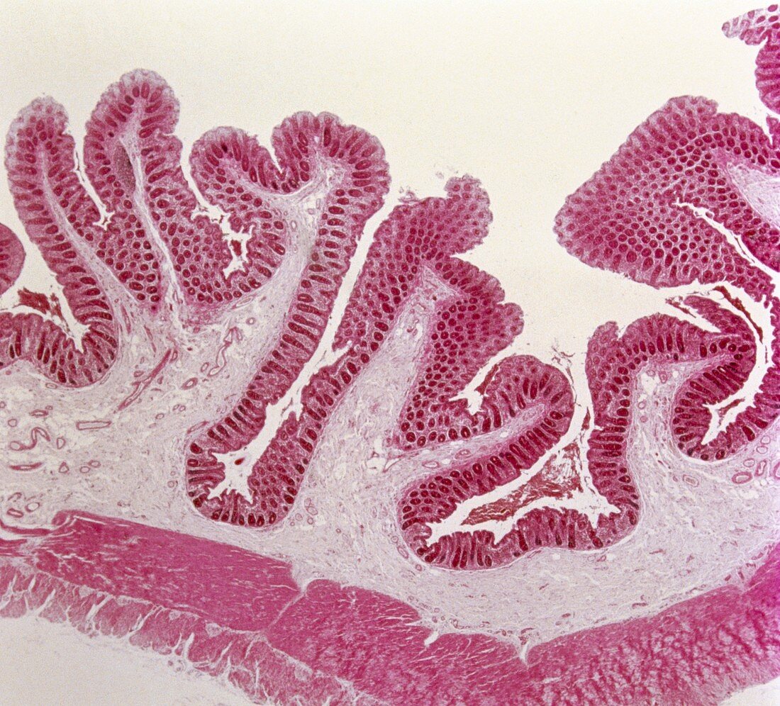 Intestinal villi,light micrograph