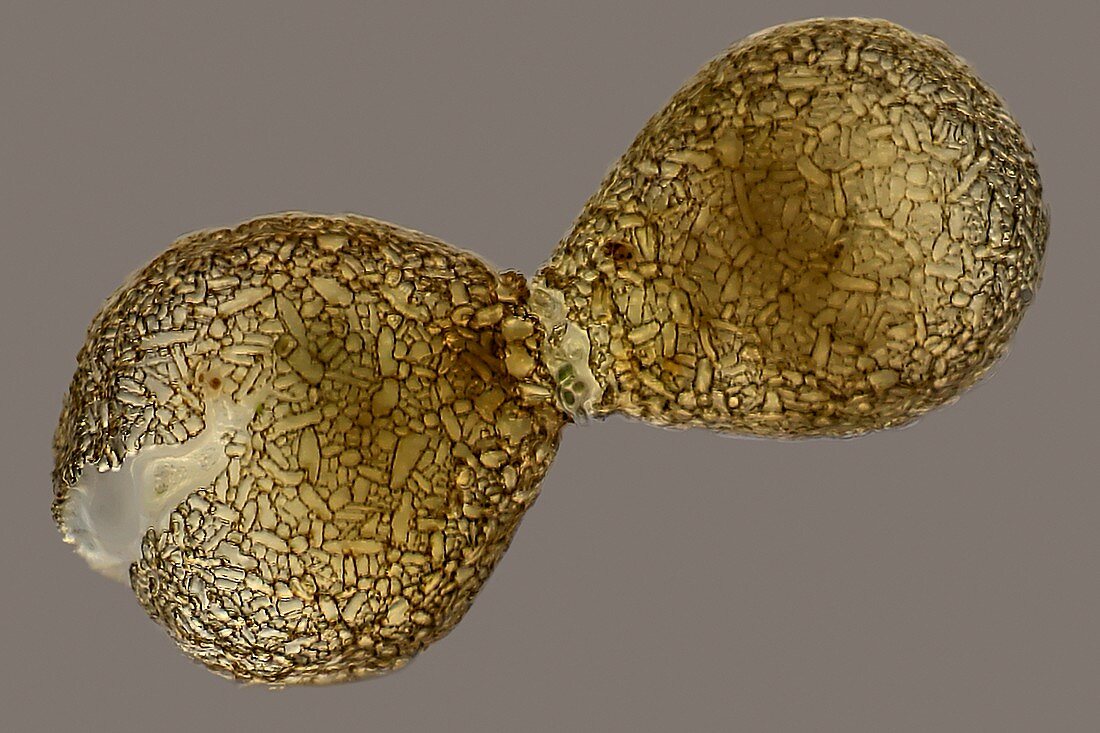 Amoeba shells,light micrograph