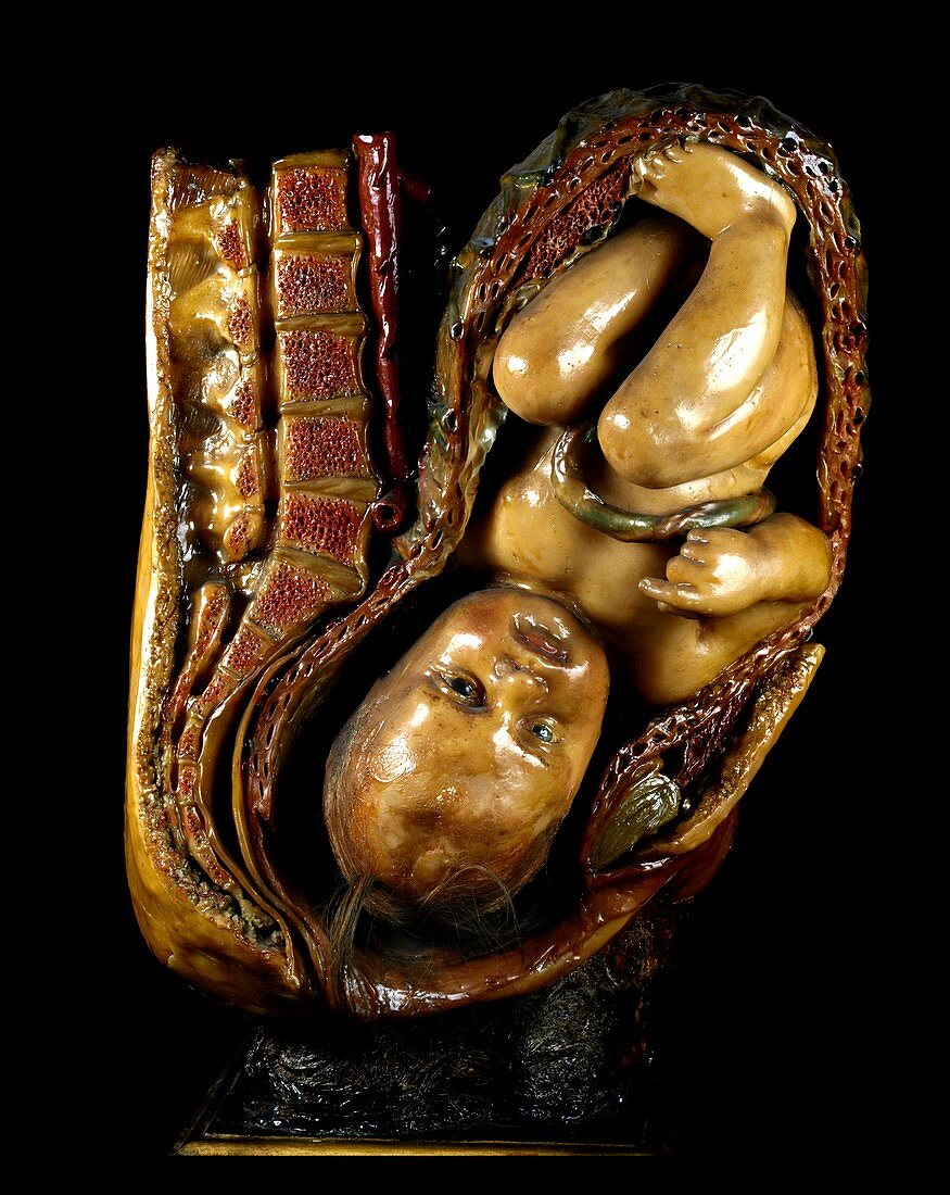 Pregnancy model,18th century