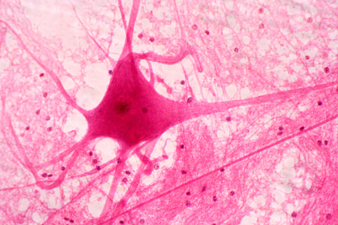 Motor neuron in an Ox spinal cord. LM