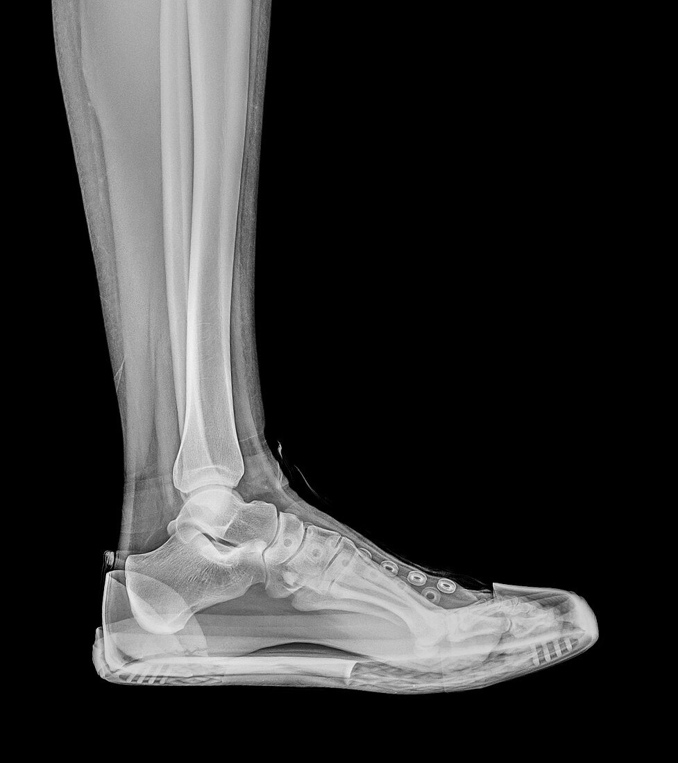 Trainers X-Ray