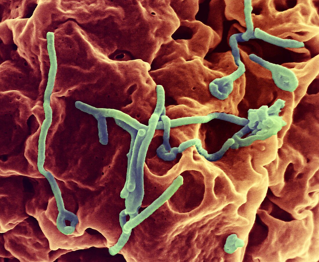 Ebola virus budding from cell,SEM