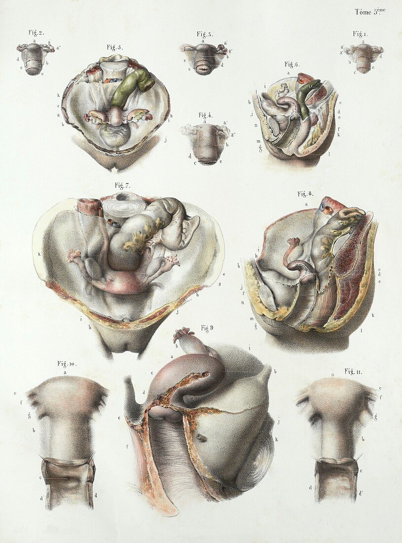 Uterus anatomy,1839 artwork