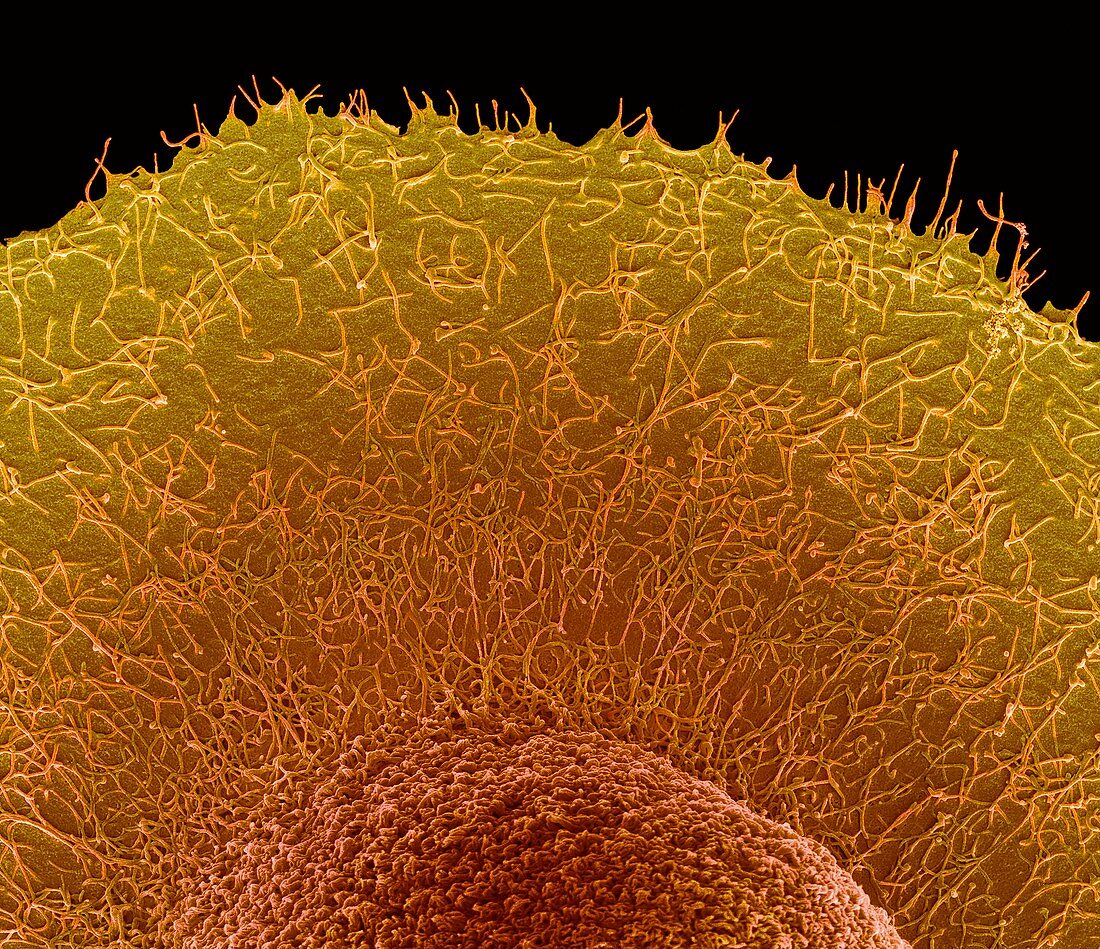 Colorectal cancer cell,SEM