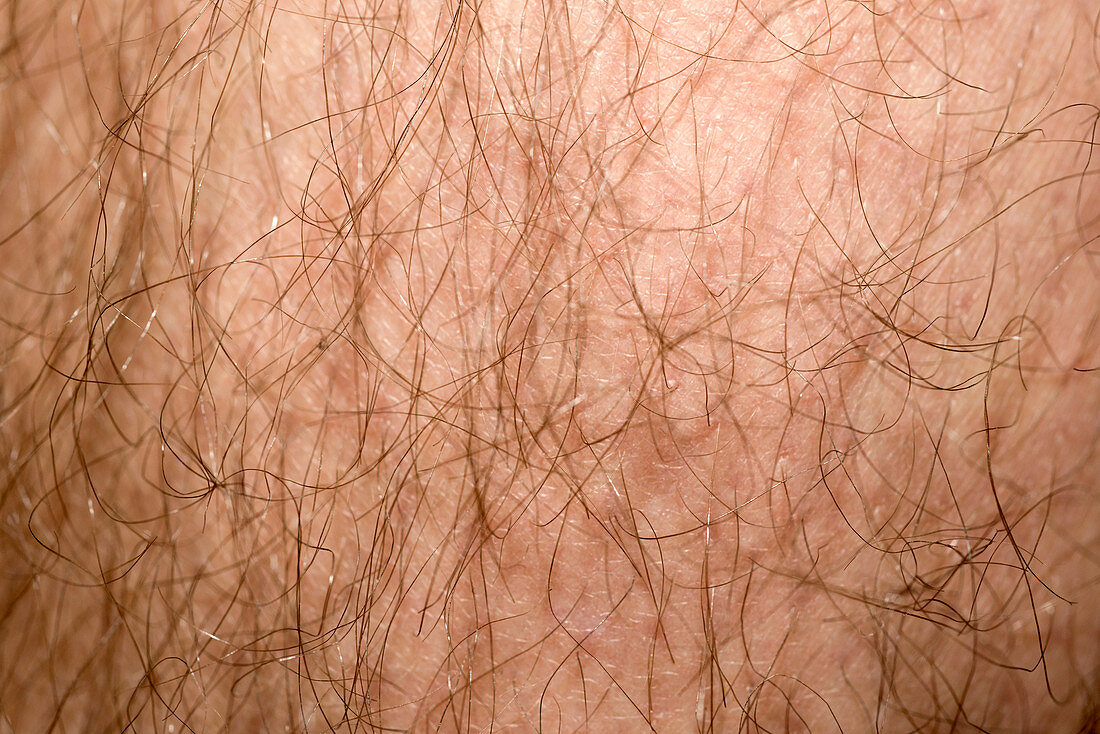 Male leg hair