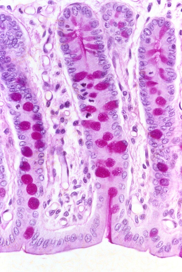 Small intestine lining,light micrograph