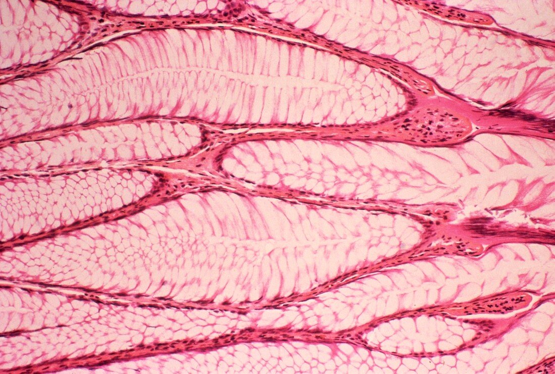 Intestinal polyp,light micrograph