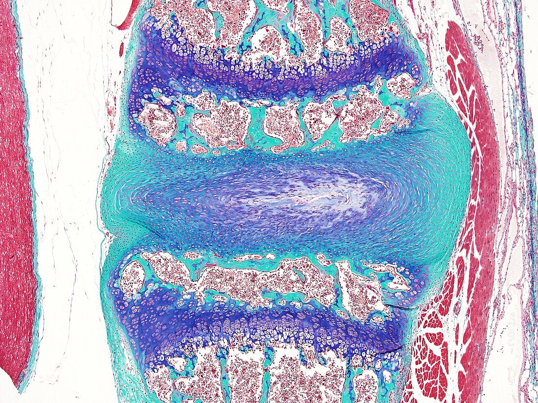 Intervertebral disc,light micrograph