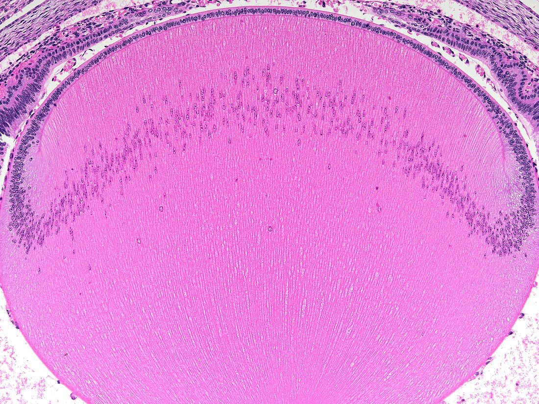 Foetal lens,light micrograph