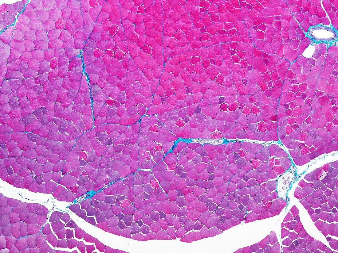 Skeletal muscle tissue,light micrograph