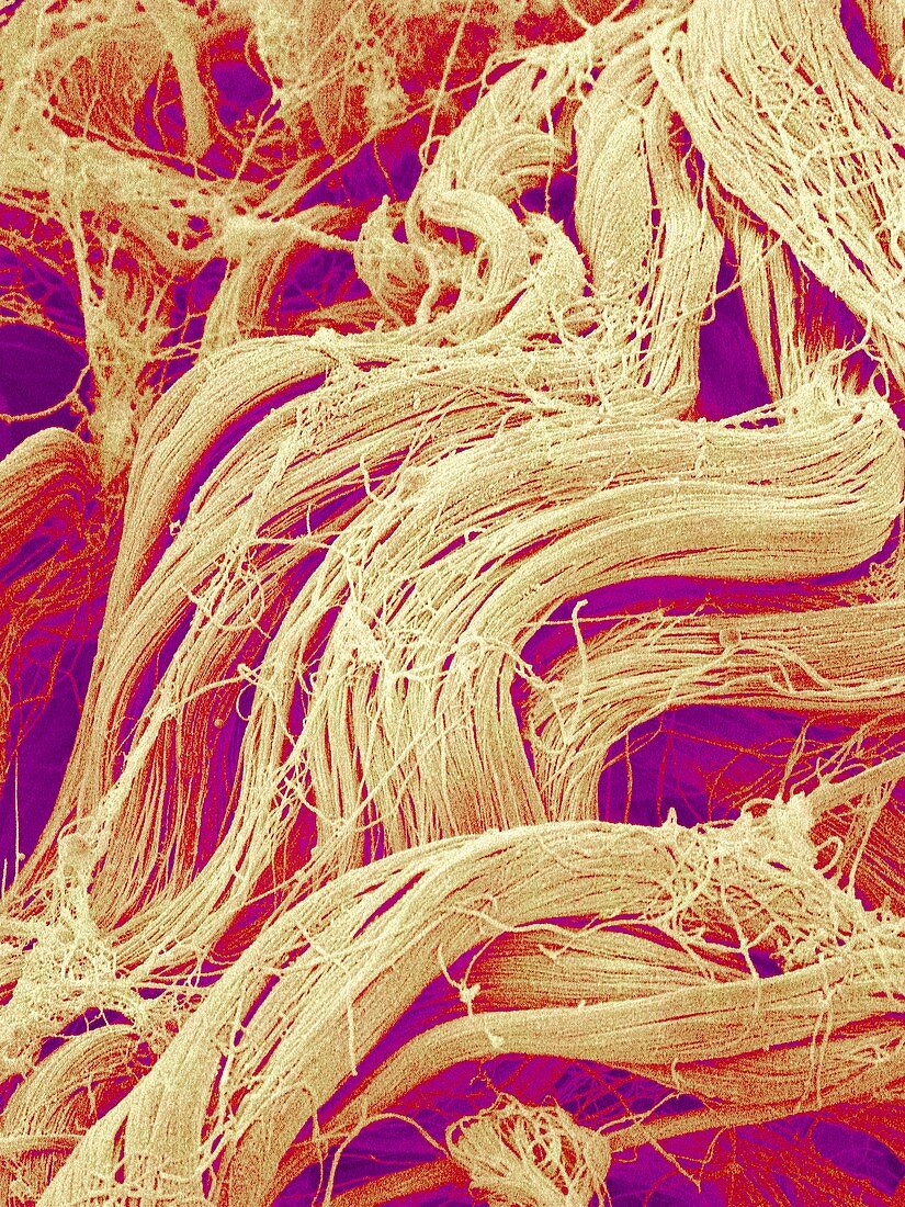 Collagen fibres,SEM