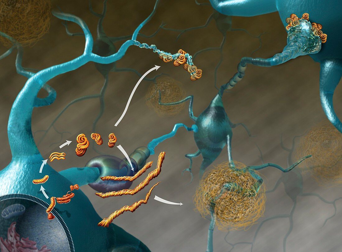 Prions in brain disease,illustration