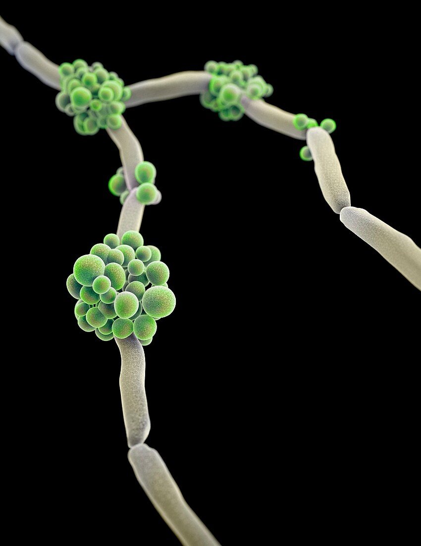 Drug-resistant Candida fungus,3D image