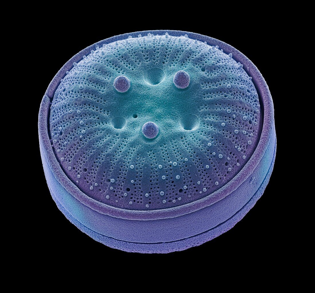 Diatom,SEM