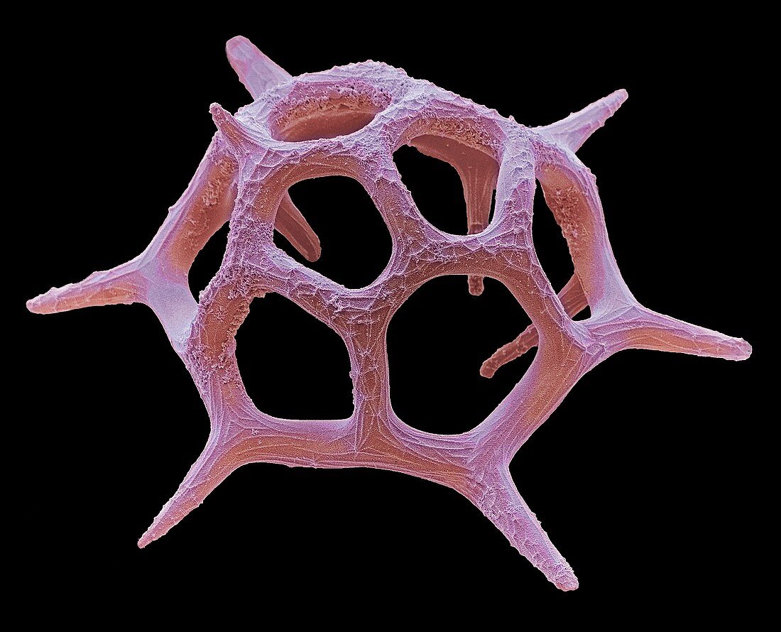 Silicoflagellate,SEM