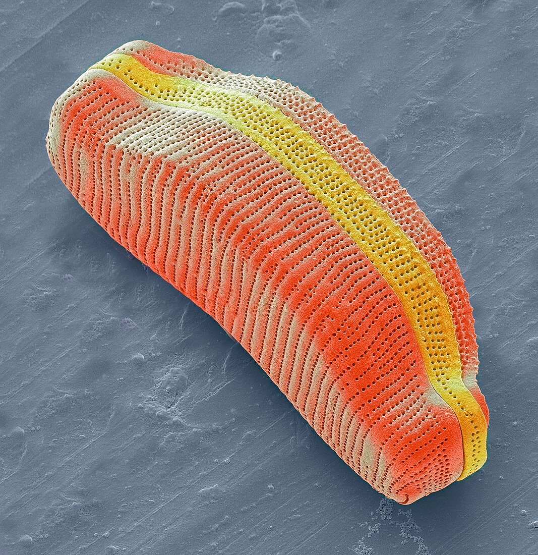 Diatom,SEM